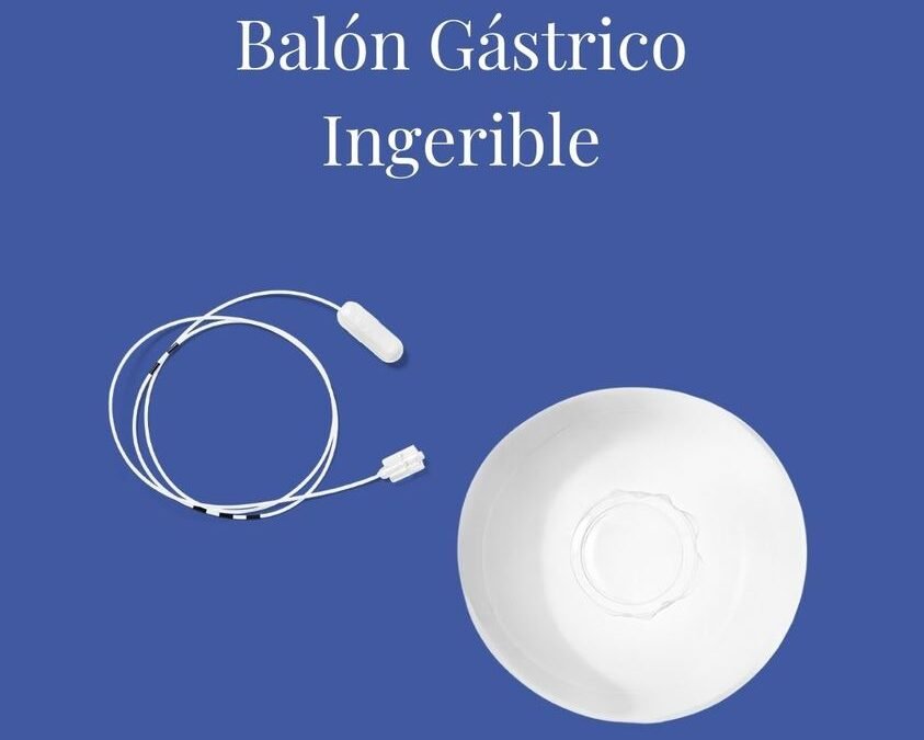 Descubre el Balón Elipse: Tu Aliado en el Camino hacia un Peso Saludable sin Cirugía
